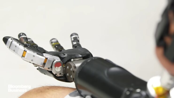 The Robot-Arm Prosthetic